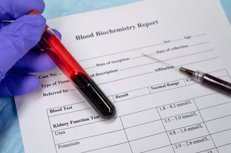 test results