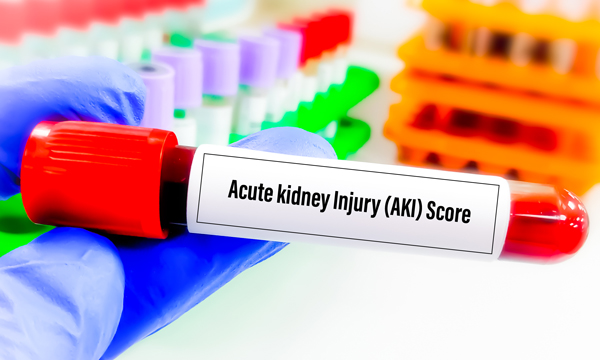 Acute kidney Injury test tube